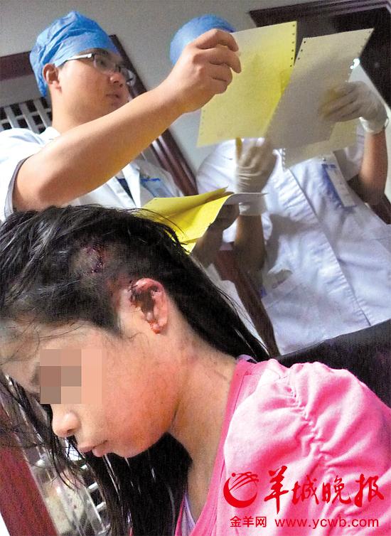 受傷的11歲女孩頭發(fā)被卷入扶梯，耳朵被嚴(yán)重拉傷，需手術(shù)。