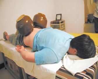拔泡菜壇子火罐。