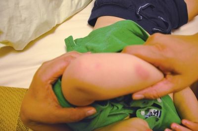 孩子身上有多處明顯傷痕。京華時(shí)報(bào)讀者供圖