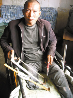 鄭艷良就是用這幾樣簡陋工具，給自己做了右腿截肢手術(shù)。