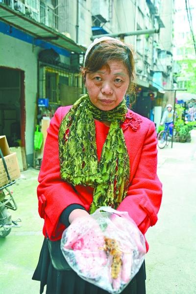 頭部受傷的黃女士展示兩根大魚刺。