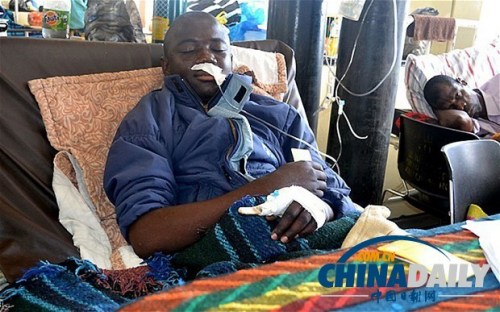 雖然已經(jīng)在醫(yī)院接受了近一個月的恢復(fù)治療，卡托卡的身體仍然非常虛弱。