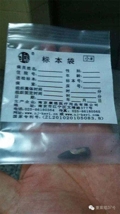 經(jīng)警方鑒定，秦女士體內(nèi)取出的子彈系56式步槍射出 。 受訪者供圖