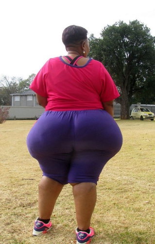 南非50歲女子臀部異常肥大遭歧視 南非50歲女子臀部異常肥大遭歧視