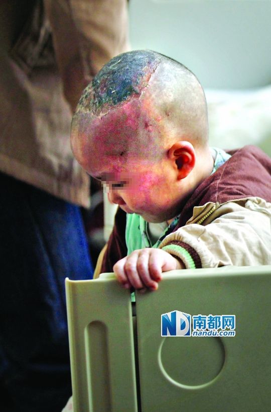 1月8日下午，小寶頭上和臉上都是傷痕。