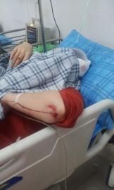 砸窗當(dāng)事人胡女士在醫(yī)院接受治療。