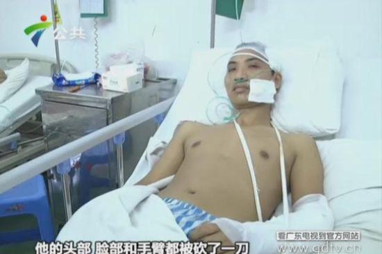 另一名傷者頭部、臉部和手臂都被砍了一刀。(視頻截圖)