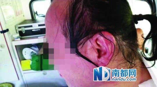 涉事教師遭熱水潑臉后的照片。