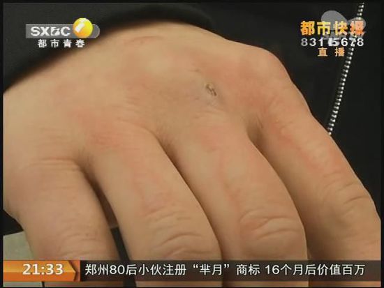 說到這足療拔罐，估計(jì)大伙都不陌生，但是想起4號(hào)晚上的拔罐的經(jīng)歷，呂先生現(xiàn)在想起來，還心有余悸。